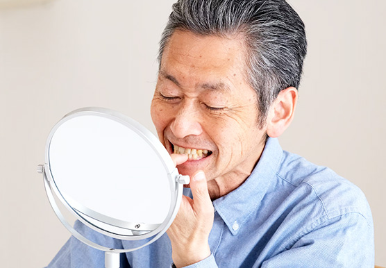 入れ歯が合わず、しっかり噛めない